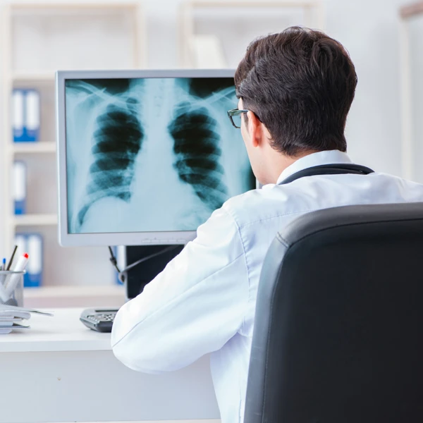 Xray Thumnail Web